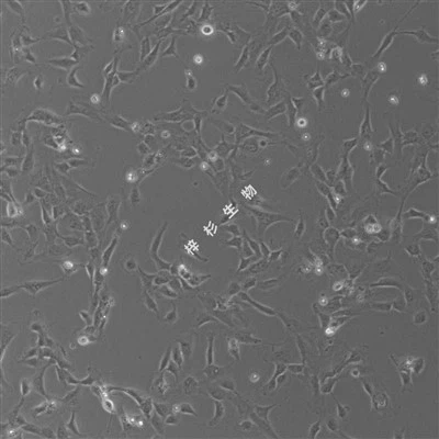 SV40T Ċellula Endoteljali tal-Vina Ombilikali tal-Bniedem Trasfettata (PUMC-HUVEC-T1) Kit tal-Medju tal-Kultura